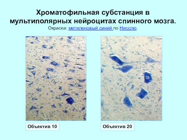 Объектив 10 Объектив 20 Хроматофильная субстанция в мультиполярных нейроцитах спинного мозга. Окраска: метиленовый синий по Нисслю.