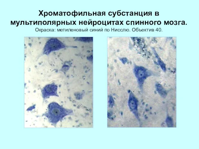 Хроматофильная субстанция в мультиполярных нейроцитах спинного мозга. Окраска: метиленовый синий по Нисслю. Объектив 40.