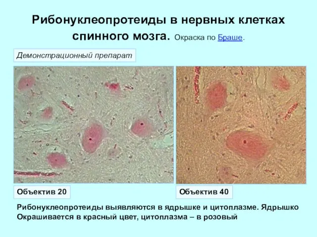 Рибонуклеопротеиды в нервных клетках спинного мозга. Окраска по Браше. Рибонуклеопротеиды выявляются