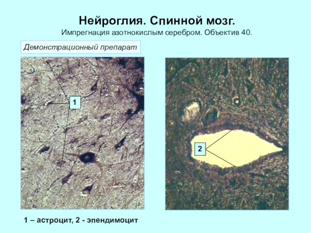 Нейроглия. Спинной мозг. Импрегнация азотнокислым серебром. Объектив 40. 1 2 1