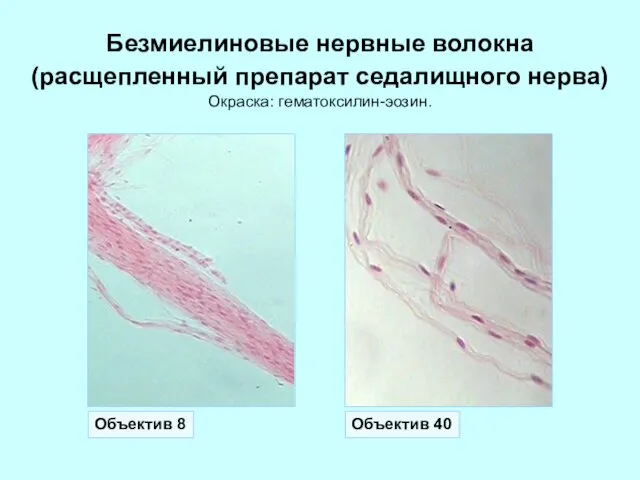 Безмиелиновые нервные волокна (расщепленный препарат седалищного нерва) Окраска: гематоксилин-эозин. Объектив 8 Объектив 40