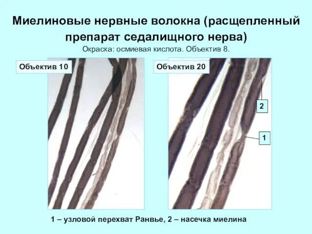 Миелиновые нервные волокна (расщепленный препарат седалищного нерва) Окраска: осмиевая кислота. Объектив