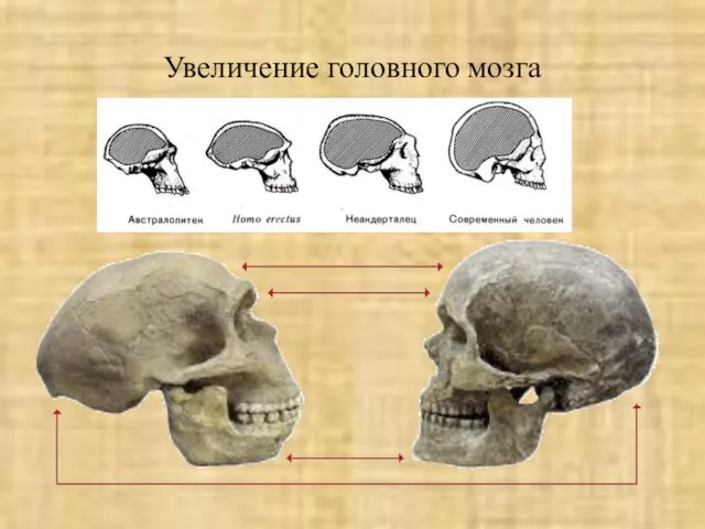 Увеличение головного мозга