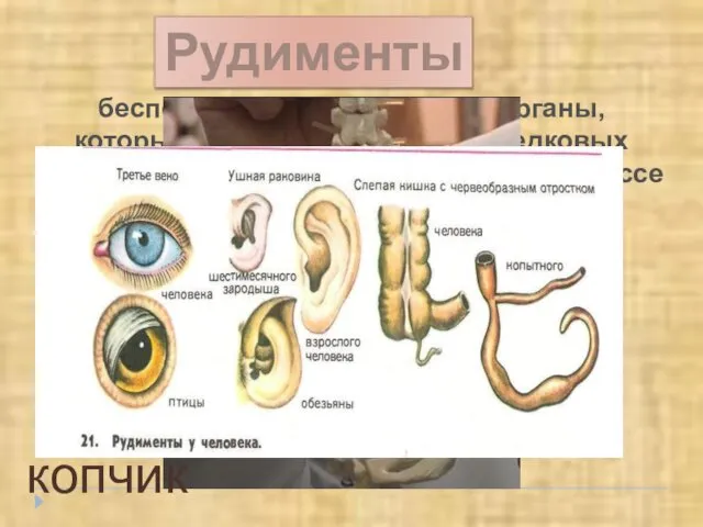 Рудименты бесполезные, недоразвитые органы, которые функционировали у предковых форм, утратившие свое