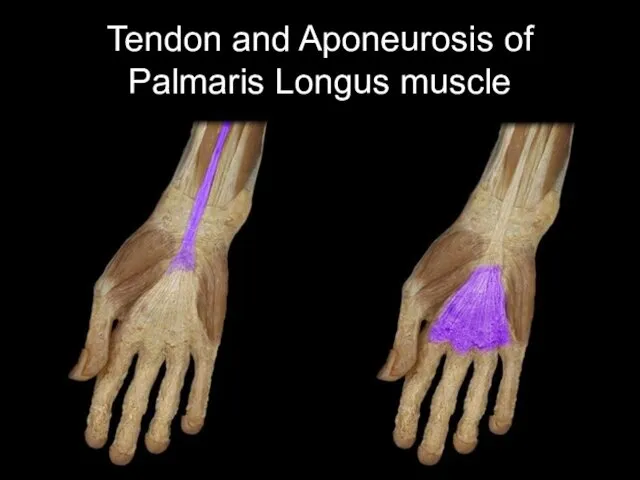 Tendon and Aponeurosis of Palmaris Longus muscle
