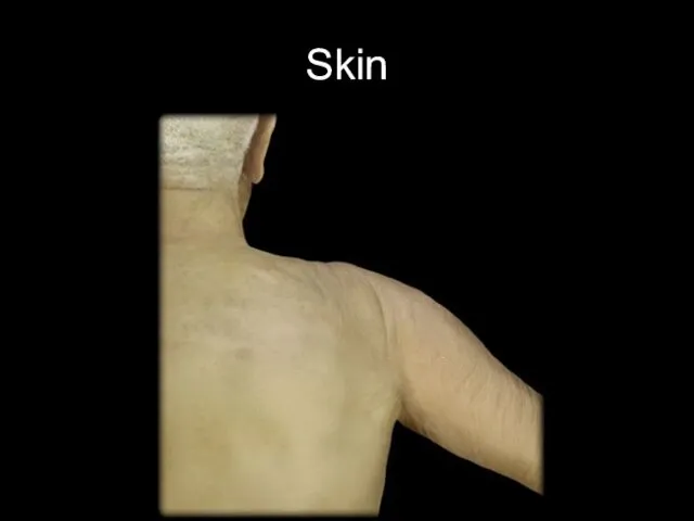 Skin