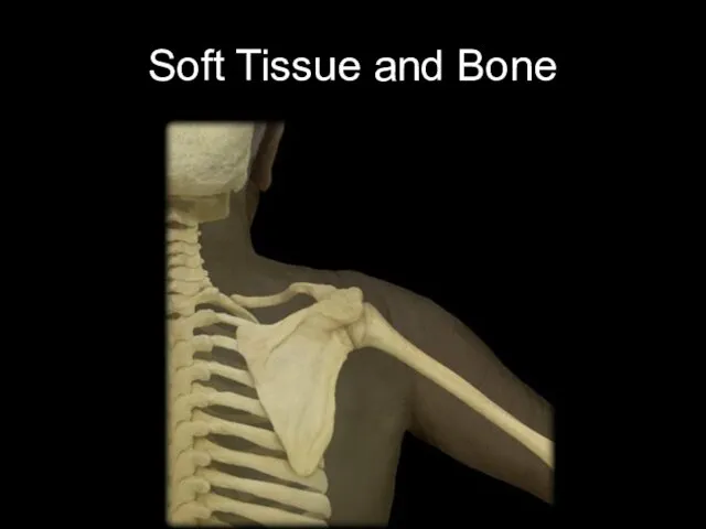 Soft Tissue and Bone