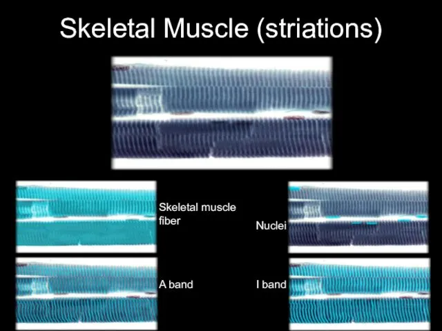 Skeletal Muscle (striations) Skeletal muscle fiber A band I band Nuclei