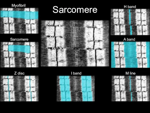 Sarcomere A band H band I band M line Myofibril Sarcomere Z disc