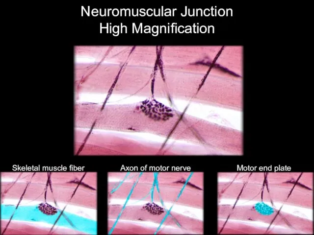 Neuromuscular Junction High Magnification Skeletal muscle fiber Axon of motor nerve Motor end plate