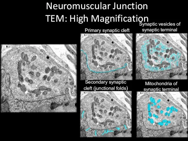 Neuromuscular Junction TEM: High Magnification Primary synaptic cleft Synaptic vesicles of