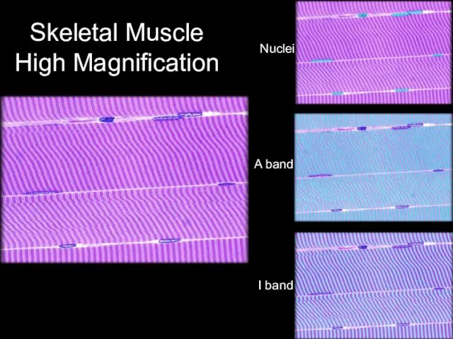 Skeletal Muscle High Magnification Nuclei A band I band