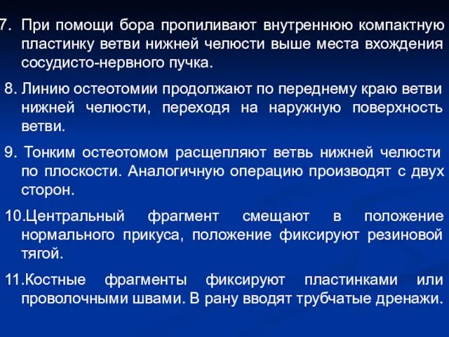 При помощи бора пропиливают внутреннюю компактную пластинку ветви нижней челюсти выше