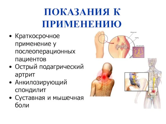 Краткосрочное применение у послеоперационных пациентов Острый подагрический артрит Анкилозирующий спондилит Суставная