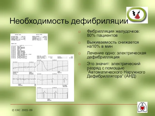 © ERC 2003-09 Необходимость дефибриляции Фибрилляция желудочков: 80% пациентов Выживаемость снижается