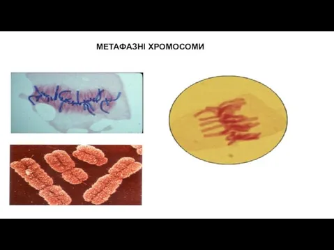 МЕТАФАЗНІ ХРОМОСОМИ