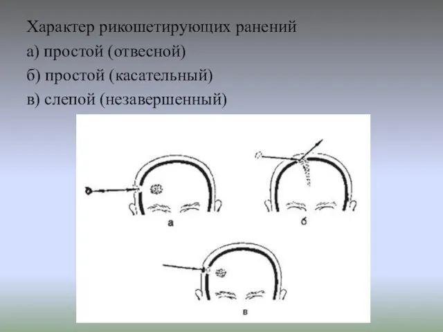 Характер рикошетирующих ранений а) простой (отвесной) б) простой (касательный) в) слепой (незавершенный)