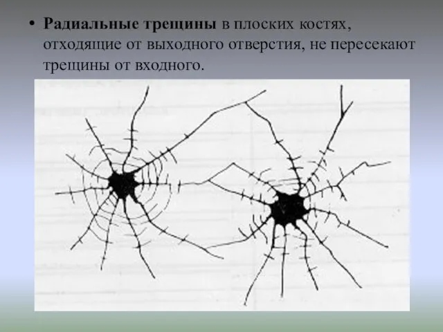 Радиальные трещины в плоских костях, отходящие от выходного отверстия, не пересекают трещины от входного.