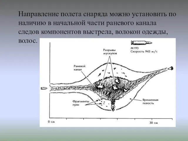 Направление полета снаряда можно установить по наличию в начальной части раневого