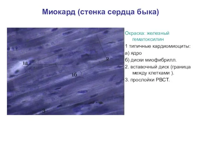 Миокард (стенка сердца быка) Окраска: железный гематоксилин 1 типичные кардиомиоциты: а)