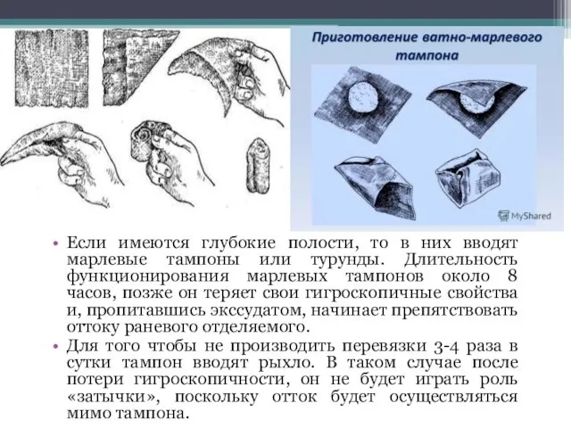 Если имеются глубокие полости, то в них вводят марлевые тампоны или