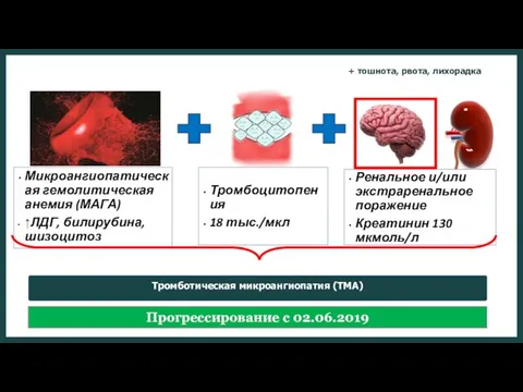 Прогрессирование с 02.06.2019 Микроангиопатическая гемолитическая анемия (МАГА) ↑ЛДГ, билирубина,шизоцитоз Тромбоцитопения 18