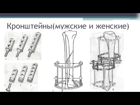 Кронштейны(мужские и женские)