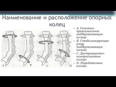 Наименование и расположение опорных колец A. Основное проксимальное поддерживающее кольцо B.