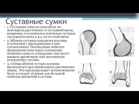 Суставные сумки 1. Суставная капсула находится на некотором расстоянии от суставной