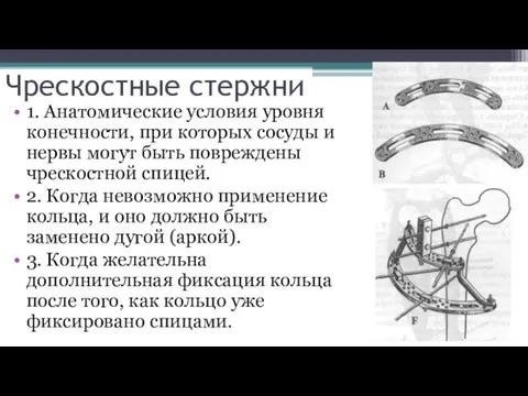 Чрескостные стержни 1. Анатомические условия уровня конечности, при которых сосуды и