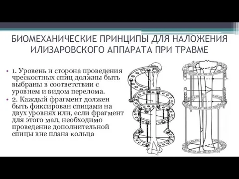 БИОМЕХАНИЧЕСКИЕ ПРИНЦИПЫ ДЛЯ НАЛОЖЕНИЯ ИЛИЗАРОВСКОГО АППАРАТА ПРИ ТРАВМЕ 1. Уровень и