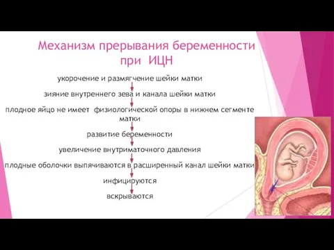 Механизм прерывания беременности при ИЦН укорочение и размягчение шейки матки зияние
