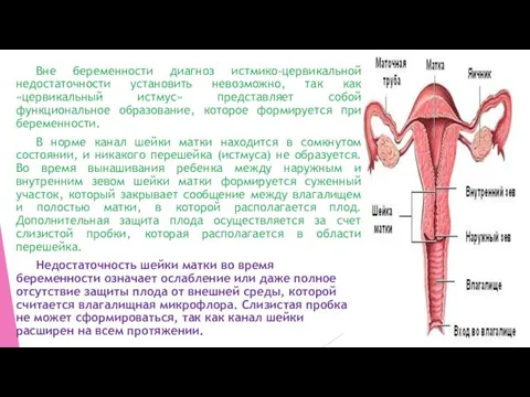 Вне беременности диагноз истмико-цервикальной недостаточности установить невозможно, так как «цервикальный истмус»