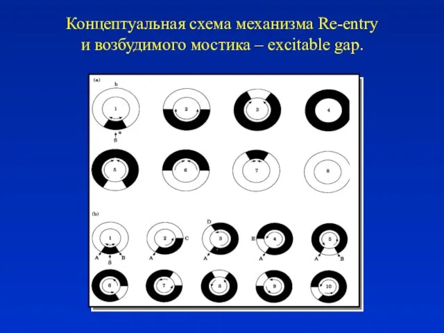 Концептуальная схема механизма Re-entry и возбудимого мостика – excitable gap.