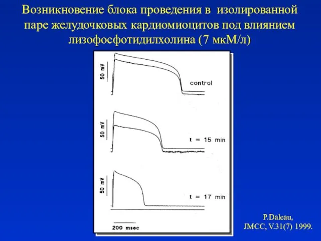 Возникновение блока проведения в изолированной паре желудочковых кардиомиоцитов под влиянием лизофосфотидилхолина