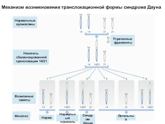 Механизм возникновения транслокационной формы синдрома Дауна