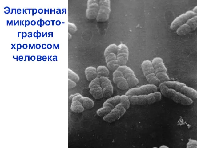 Электронная микрофото-графия хромосом человека