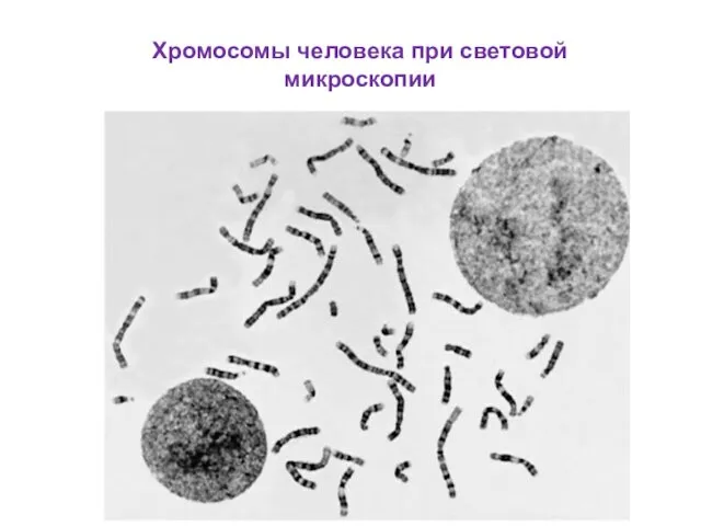 Хромосомы человека при световой микроскопии