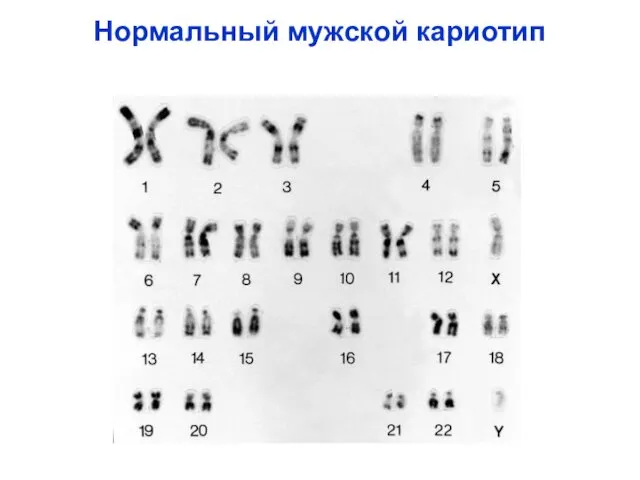 Нормальный мужской кариотип