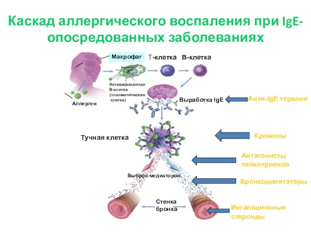 Каскад аллергического воспаления при IgE- опосредованных заболеваниях Выработка IgE T-клетка B-клетка