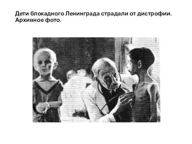Дети блокадного Ленинграда страдали от дистрофии. Архивное фото.