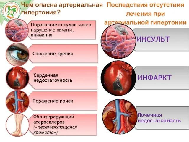 Последствия отсутствия лечения при артериальной гипертонии Чем опасна артериальная гипертония?