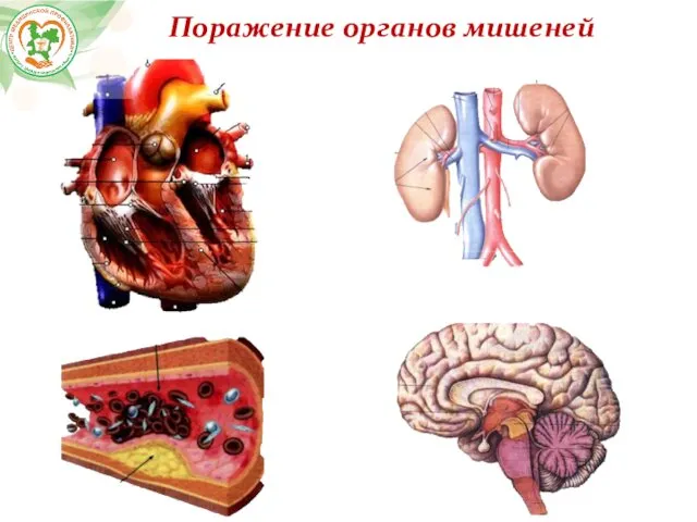 Поражение органов мишеней