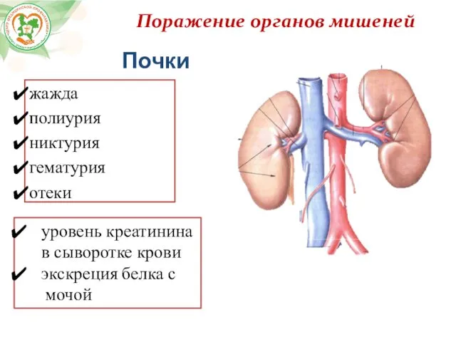 Поражение органов мишеней Почки жажда полиурия никтурия гематурия отеки уровень креатинина