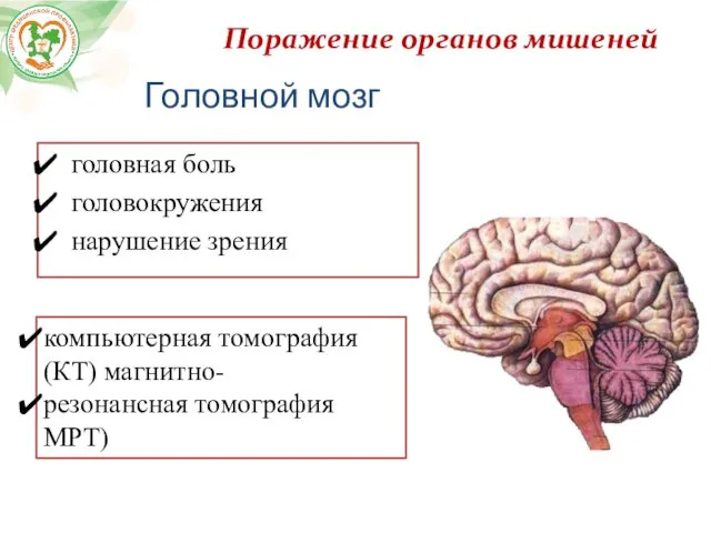 Поражение органов мишеней Головной мозг головная боль головокружения нарушение зрения компьютерная