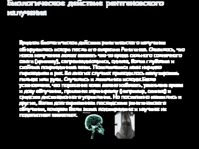 Биологическое действие рентгеновского излучения Вредное биологическое действие рентгеновского излучения обнаружилось вскоре