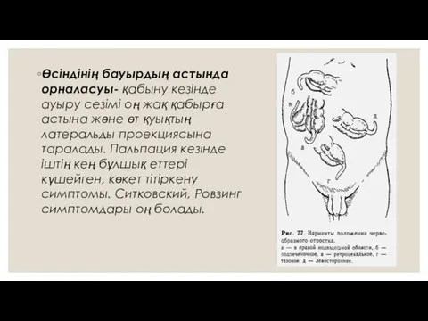 Өсіндінің бауырдың астында орналасуы- қабыну кезінде ауыру сезімі оң жақ қабырға