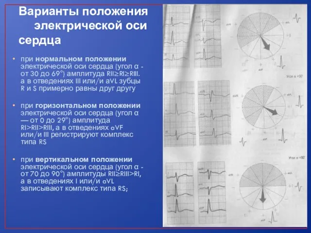 Варианты положения электрической оси сердца при нормальном положении электрической оси сердца