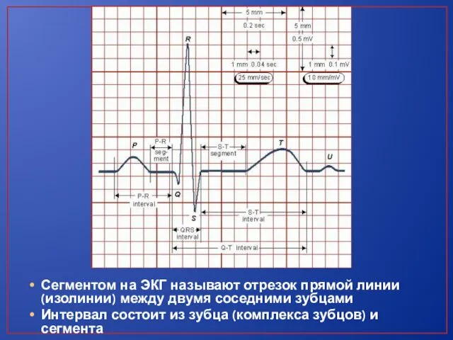 Сегментом на ЭКГ называют отрезок прямой линии (изолинии) между двумя соседними