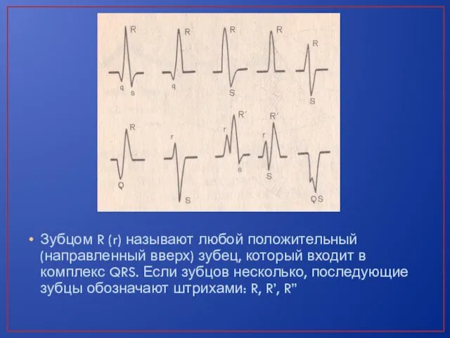 Зубцом R (r) называют любой положительный (направленный вверх) зубец, который входит